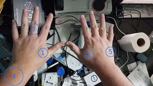 网友风控系统抽查审核系统检测无法出款不准提现在线支招的解决方案(图)